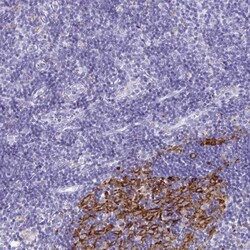 CDCA4 Antibody, Novus Biologicals 0.1mL; Unlabeled:Antibodies, Polyclonal
